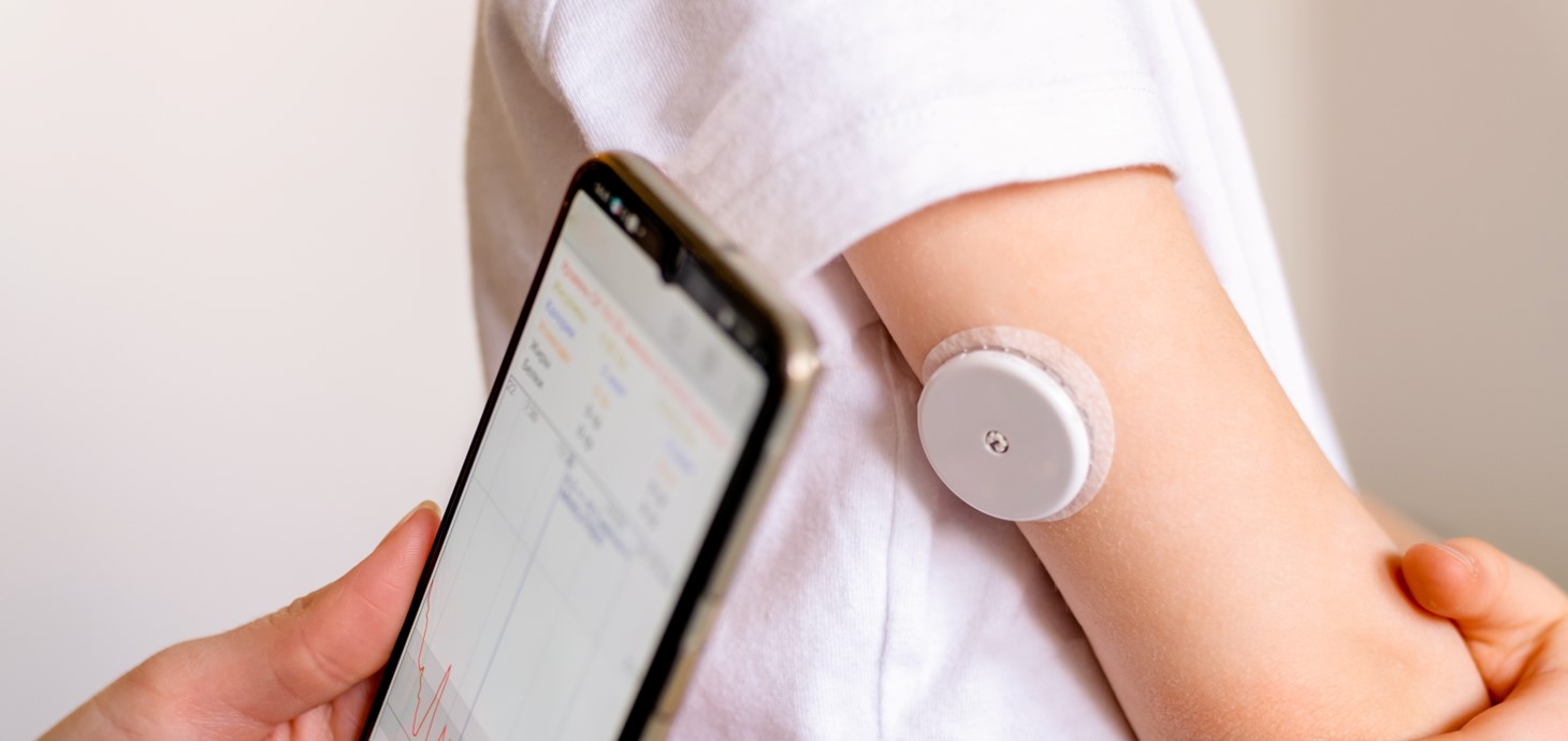 Continuous glucose monitoring system on child's arm being checked on a smartphone.